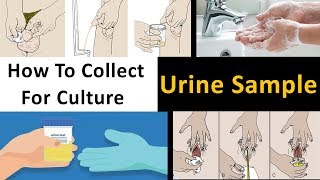 How to Collect Urine Sample For Culture [upl. by Genet]