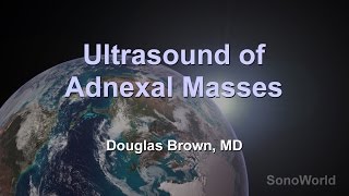 quotUltrasound of Adnexal Massesquot Ultrasound SonoWorld Lecture [upl. by Bausch167]