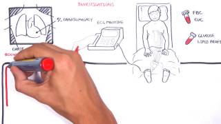 Acute Coronary Syndrome DETAILED Overview MI STEMI NSTEMI [upl. by Nogras]