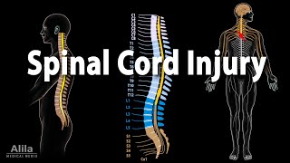 Spinal Cord Injury Animation [upl. by Aniretake]