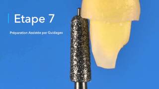 anterior crown sep by step N°9 ADN la couronne antérieure [upl. by Anoyet]