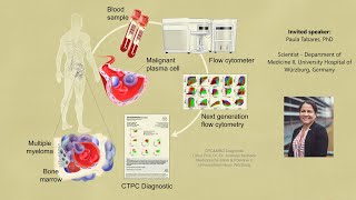 Monitoring Circulating Plasma Cells in routine diagnostics in Multiple Myeloma [upl. by Dean665]