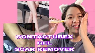 PAANO GAMITIN ANG CONTRACTUBEX GEL SCAR REMOVER UPDATE [upl. by Nnylylloh289]