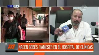 Nacen bebés siameses en el hospital de Clínicas [upl. by Ylrebmik]