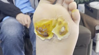 Pedicure Tutorial：Gently repairs the soles of the feet [upl. by Shanda534]