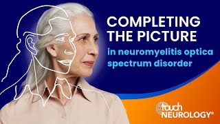 Considering the complete picture in neuromyelitis optica spectrum disorder [upl. by Baalbeer]