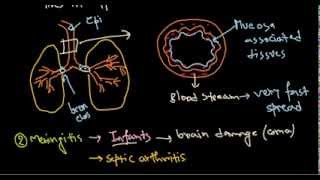 Haemophilus influenzae infection [upl. by Milburt]