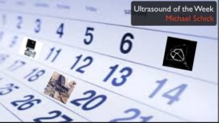 Ultrasound of the Week  Parotitis [upl. by Assele]