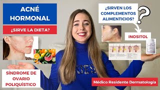 ACNÉ HORMONAL 2022 ¿SIRVE LA DIETA  SÍNDROME DE OVARIO POLIQUÍSTICO TRATAMIENTO  INOSITOL [upl. by Esinyt]