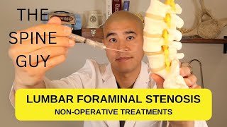 Lumbar Foraminal Stenosis  Non Operative Treatments [upl. by Schnell]