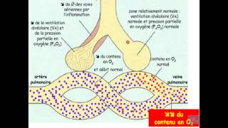 Semiologie de linsuffisance respiratoire Partie 1 [upl. by Anoiuq942]