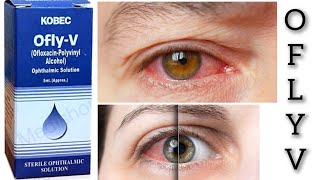 ofly v eye drop uses in urdu Hindi👁️ [upl. by Tound]