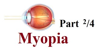 myopia  pathology and risk factors Part 24 [upl. by Ellenohs968]