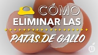 Cómo eliminar las patas de gallo  Cómo quitar las arrugas de los ojos [upl. by Trill934]