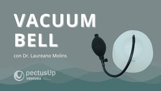 ¿Qué es el Vacuum Bell o Campana de vacío  Pectus Excavatum  Dr Laureano Molins [upl. by Pickard]