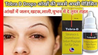 ✅Tobra D Drops आंखों में जलन  खटक  लाली  चुभन  एलर्जी  इन सब में दे तुरंत राहत side effects [upl. by Seidnac770]