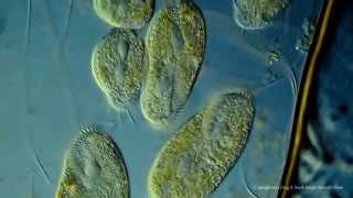 Various Ciliated Protozoa Kingdom Protista DIC Lighting Technique [upl. by Crispas375]