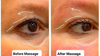 5 MINUTE Effective Massage to Tighten Droopy Eyelid  Eyebrow Lifting Massage [upl. by Hairam343]