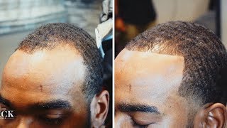 Barber Shows How To Get Your Thinning Hairline Back  Barber Spotlight 4 Tahir Woods [upl. by Ydnik]