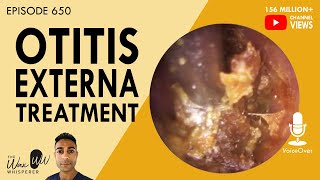 650  Treatment of Otitis Externa [upl. by Avenej]