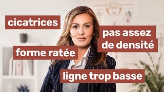 Quoi faire après une greffe de cheveux ratée [upl. by Winn]