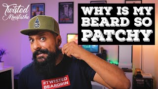 My Beard Is Patchy How To Deal With Patchy Beard Growth [upl. by Suzann588]