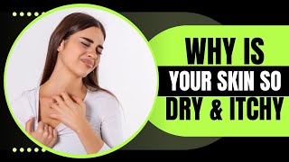 10 Reasons Behind Your Dry Itchy Skin – And How to Prevent It [upl. by Ahsitruc285]