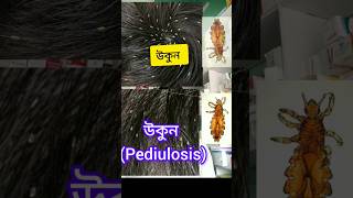 Pediulosis উকুন [upl. by Sitrik]