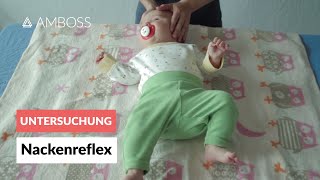 Asymmetrischer tonischer Nackenreflex  Pädiatrie  Frühkindliche Reflexe  AMBOSS Video [upl. by Ettennaej766]