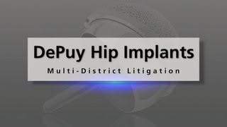 Defective Depuy Hip Implant Recall [upl. by Eeresid]