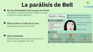 Parálisis de Bell vs Derrame Cerebral Aprende a Diferenciarlos en Un Minuto [upl. by Tu]