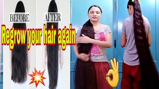 Best remedy for hair growthरुकी हुई हेयर ग्रोथ को दोबारा शुरू करने का सबसे अच्छा गरेलू तरीका👌💇👍 [upl. by Nidroj]