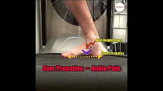 Over pronation can cause foot and ankle pain [upl. by Rosalinda537]