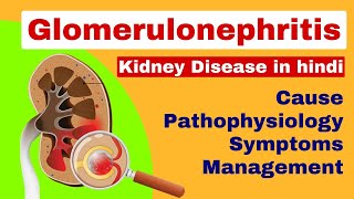 Glomerulonephritis  Nephritis in hindi  kidney disease  medical surgical nursing lecture [upl. by Adelric592]