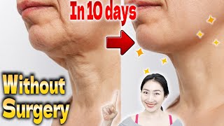 Lift Turkey Neck Without Surgery in 10 days Ultimate Massage for Neck Wrinkles [upl. by Amann392]