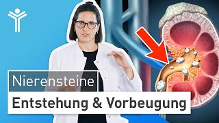 Nierensteine – Was tun Entstehung und Vorbeugung einfach erklärt [upl. by Macey]