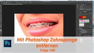 Mit Photoshop Zahnspange entfernen  Folge 149 [upl. by Chrystel]