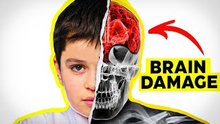 How Real is Brain Damage in Kids MMA CTE [upl. by Melise361]