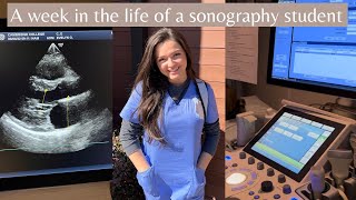 Week in the life of a Sonography Student [upl. by Lasky]