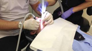 dentist injection drill and filling [upl. by Trotter]