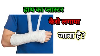 How to Apply POP COST FOR WRIST JOINT [upl. by Anitsuj712]