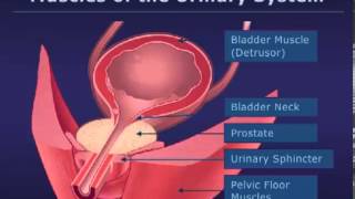 Botox Injections for Bladder Conditions [upl. by Moriah]