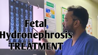 Fetal Hydronephrosis in Pregnancy Treatment  Pregnancy me Bach ki kidney me sujan ka ilaj in hindi [upl. by Zulch850]