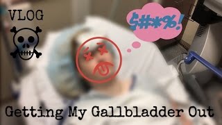 My Gallbladder Surgery Story VLOG  Chronic Cholecystitis [upl. by Maressa87]