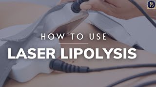 How to use Laser Lipolysis bodysculpting [upl. by Cordle]