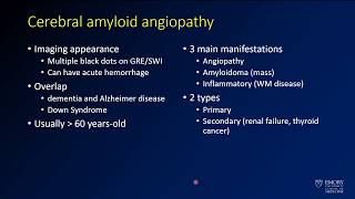 Imaging intracranial hemorrhage  Case 6  Cerebral amyloid angiopathy  CAA [upl. by Arahsat739]