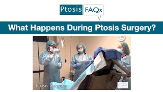 What Happens During Ptosis Surgery as Performed by Oculoplastic Surgeon Dr Amiya Prasad [upl. by Yrtnej]