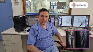 Lets Talk about Digital Subtraction Angiography [upl. by Nahk]