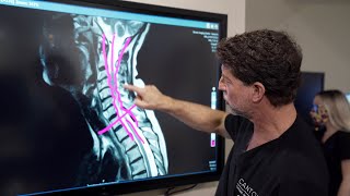 Symptoms of Cervical Stenosis  Jeffrey Cantor MD [upl. by Tess]