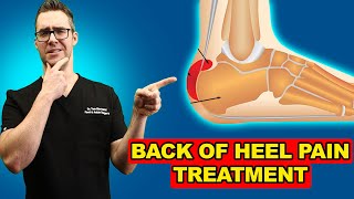 Retrocalcaneal Heel Bursitis Pain in the back of the Heel TREATMENT [upl. by Osborne616]